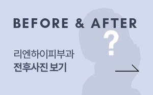 해운대 피부과 전후사진