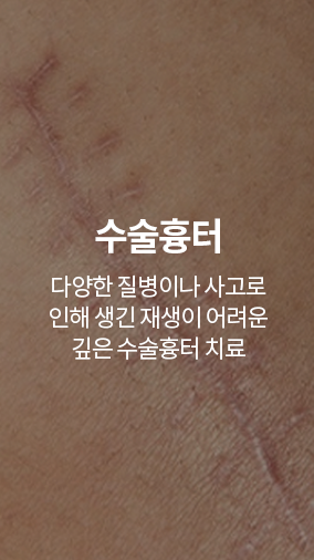 수술흉터