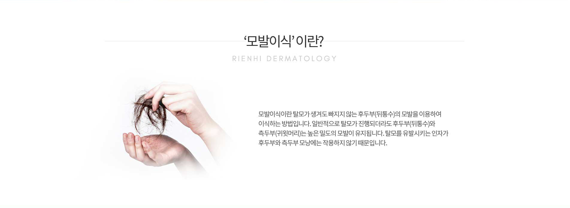 모발이식이란