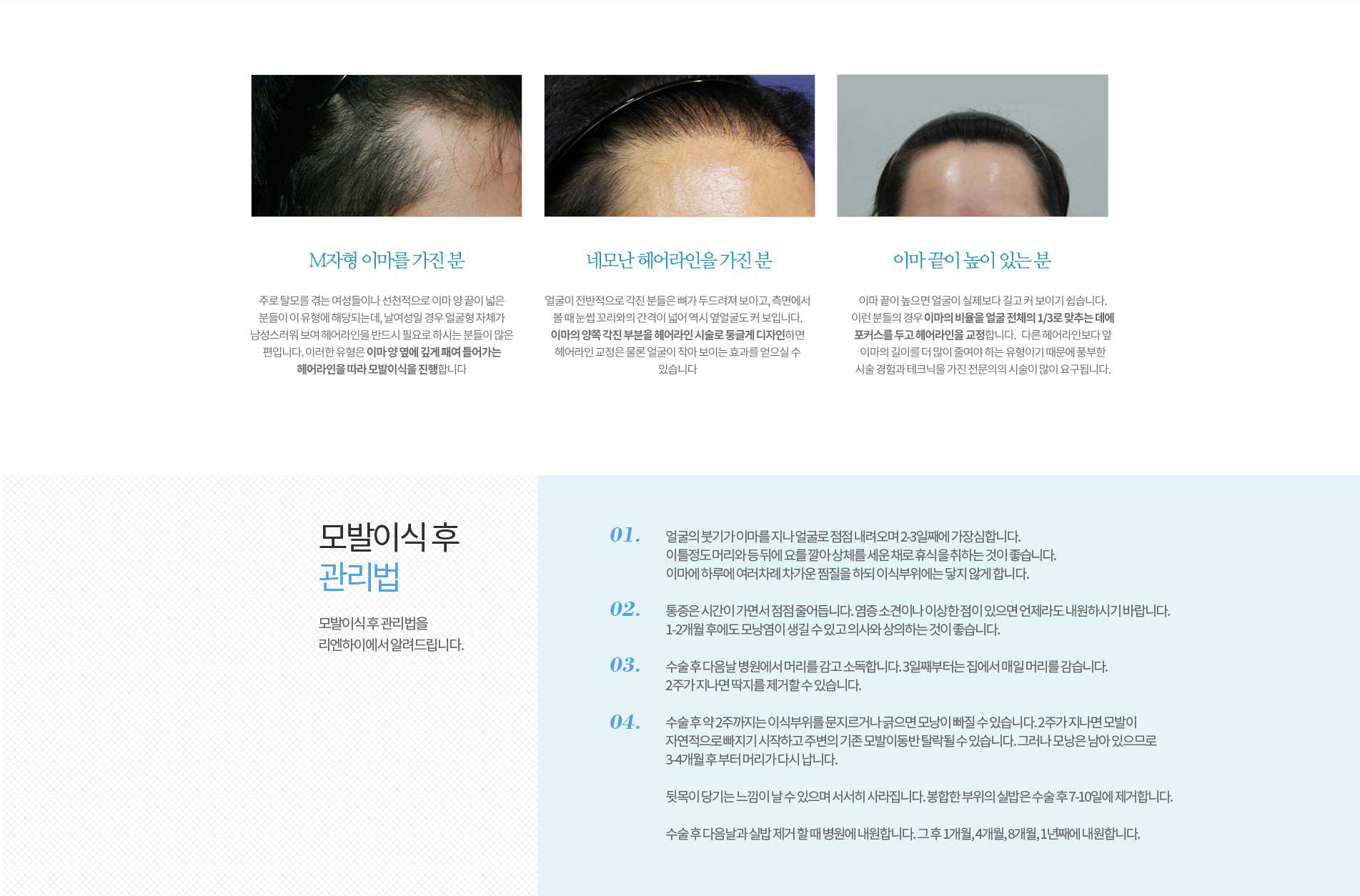 모발이식후 관리법