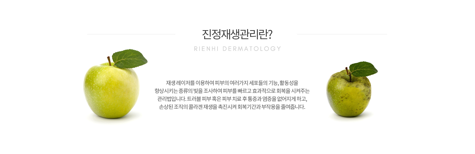 진정재생관리란