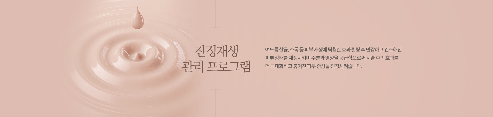 진정재생관리프로그램