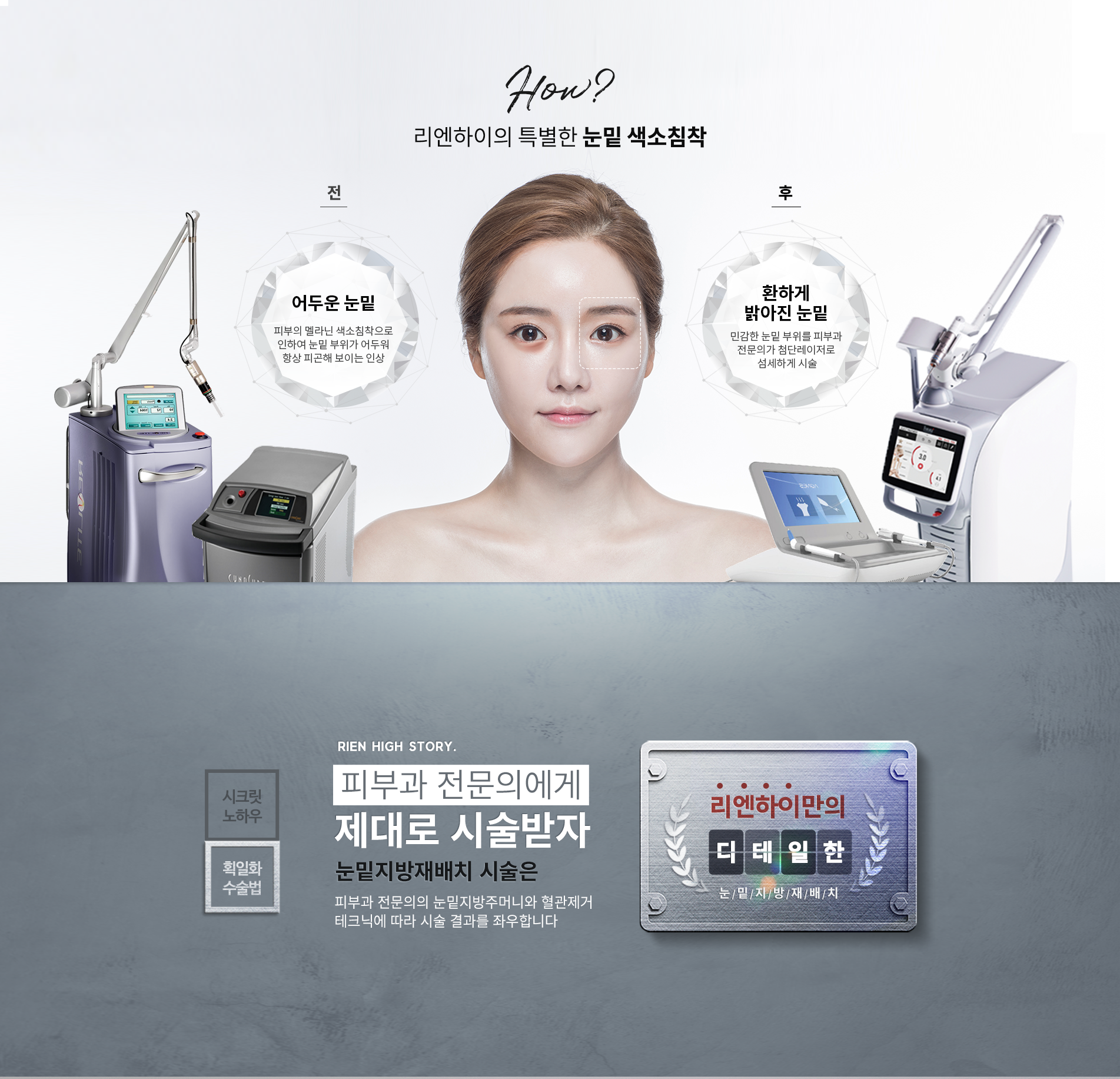 리엔하이의 특별한 눈밑 색소침착,피부과전문의에게 제대로 시술받자