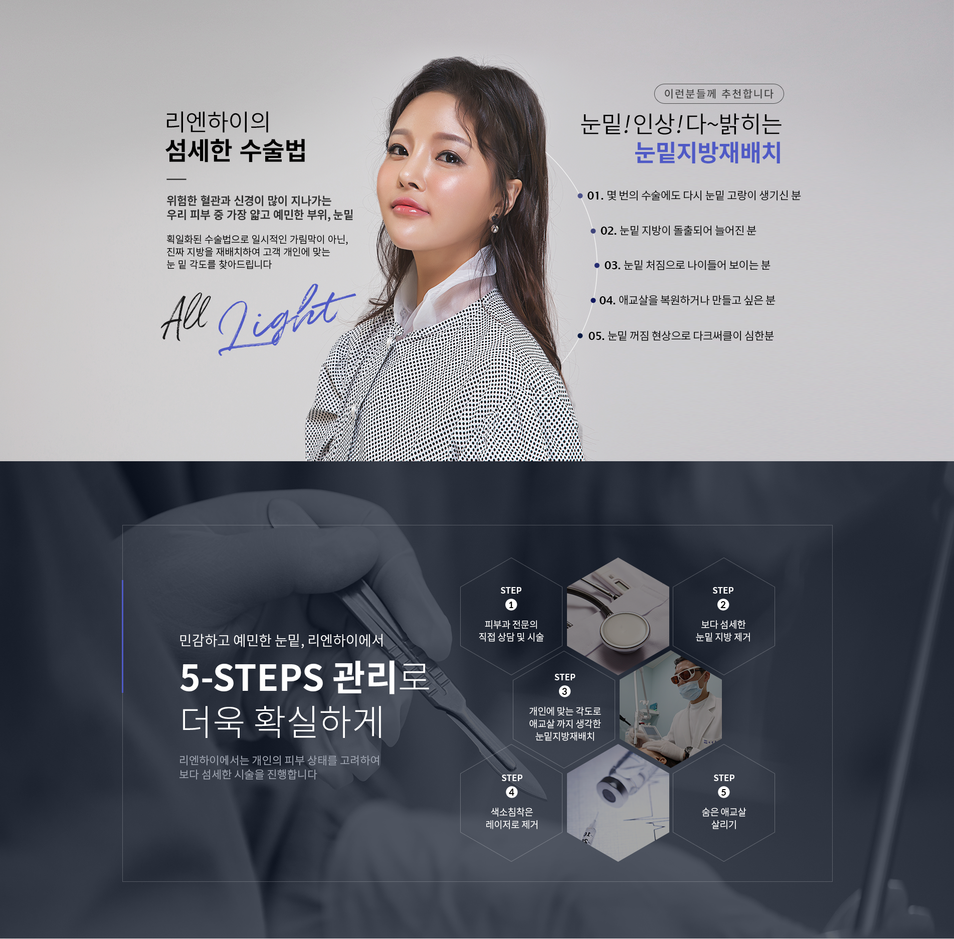 리엔하이의 섬세한 수술법