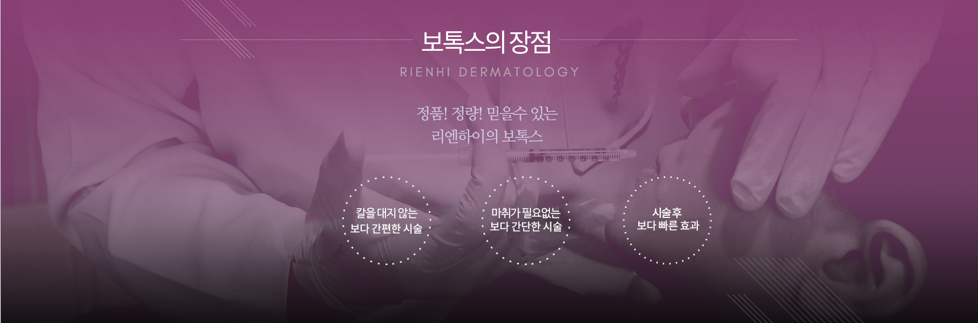 보톡스의장점
