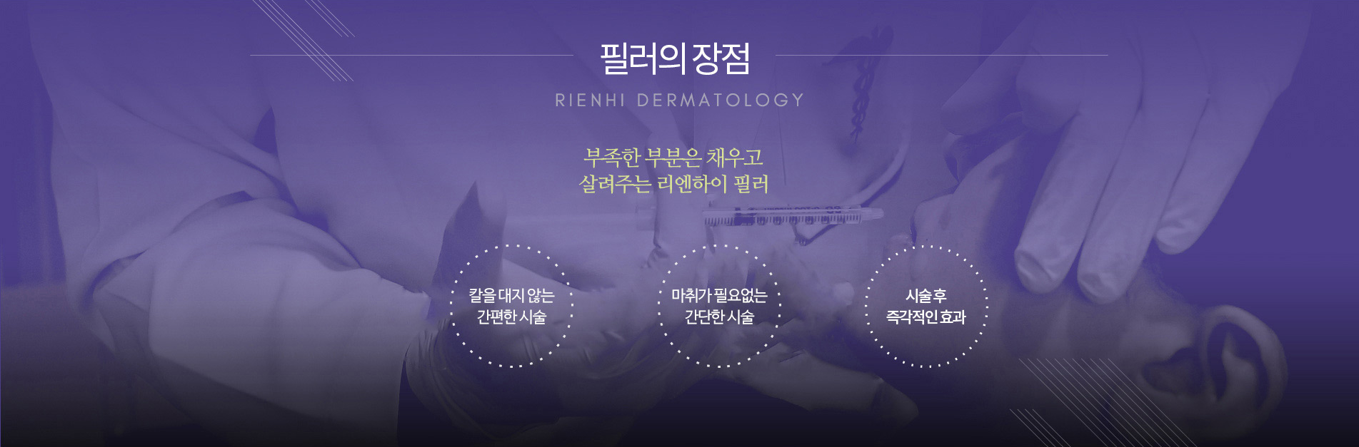 필러의장점
