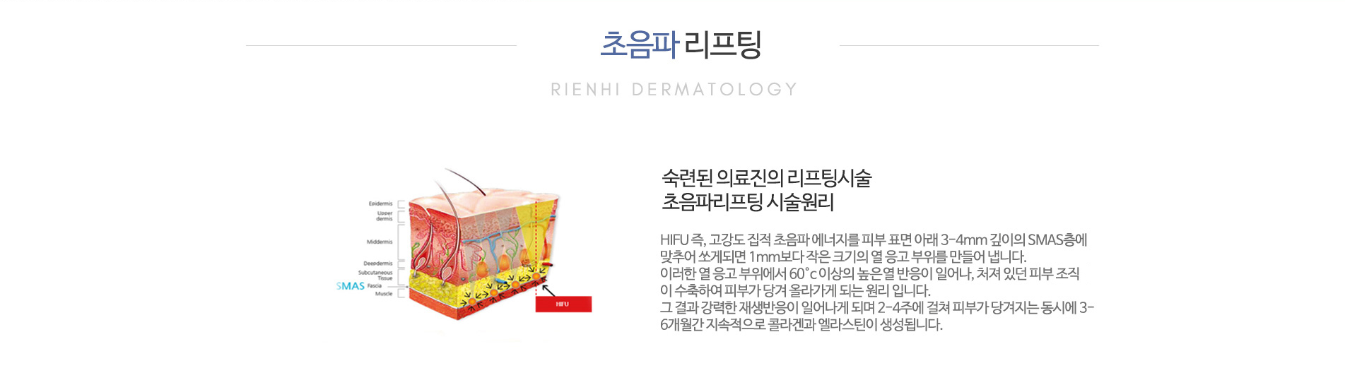 초음파리프팅