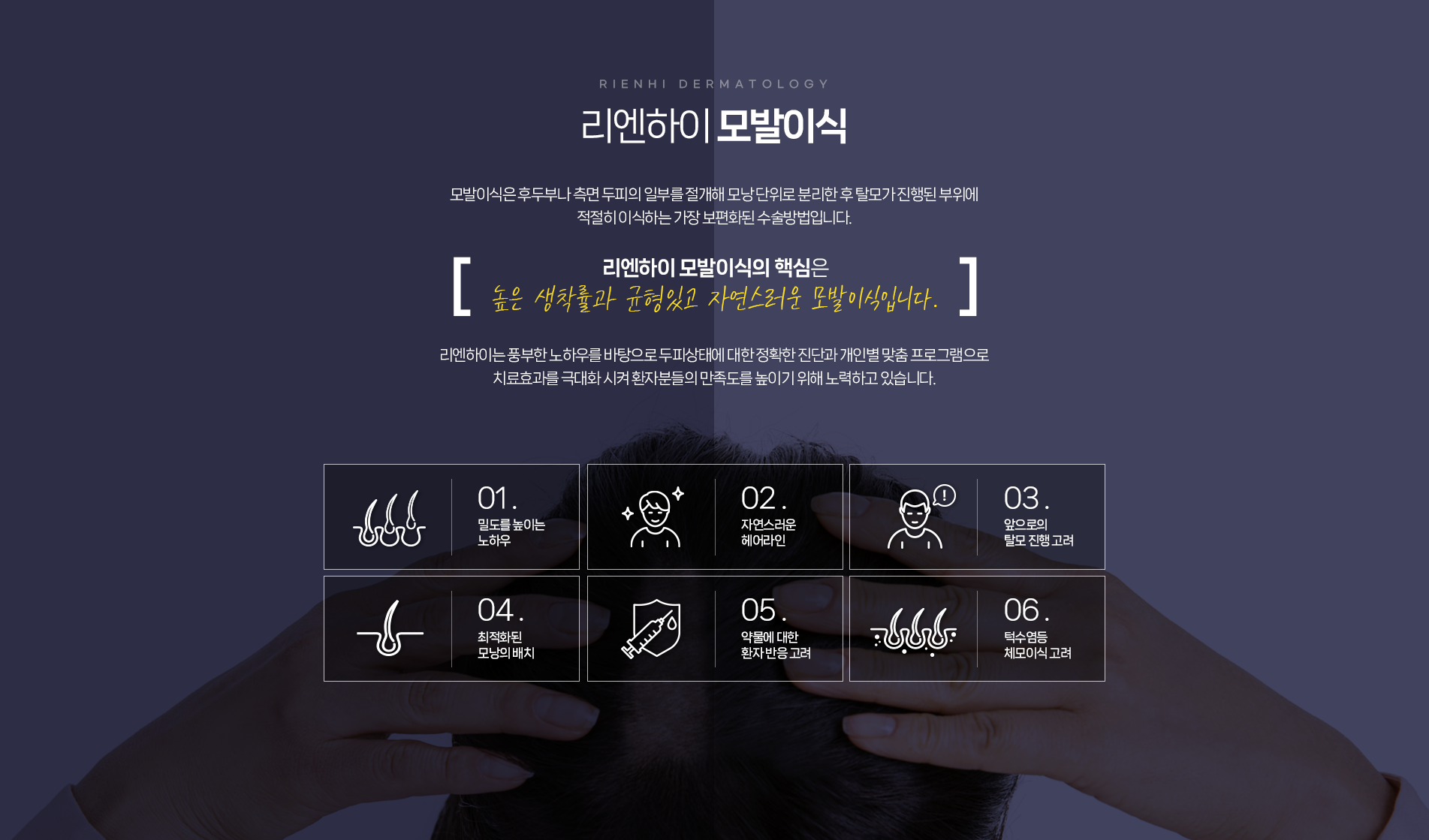모발이식 핵심