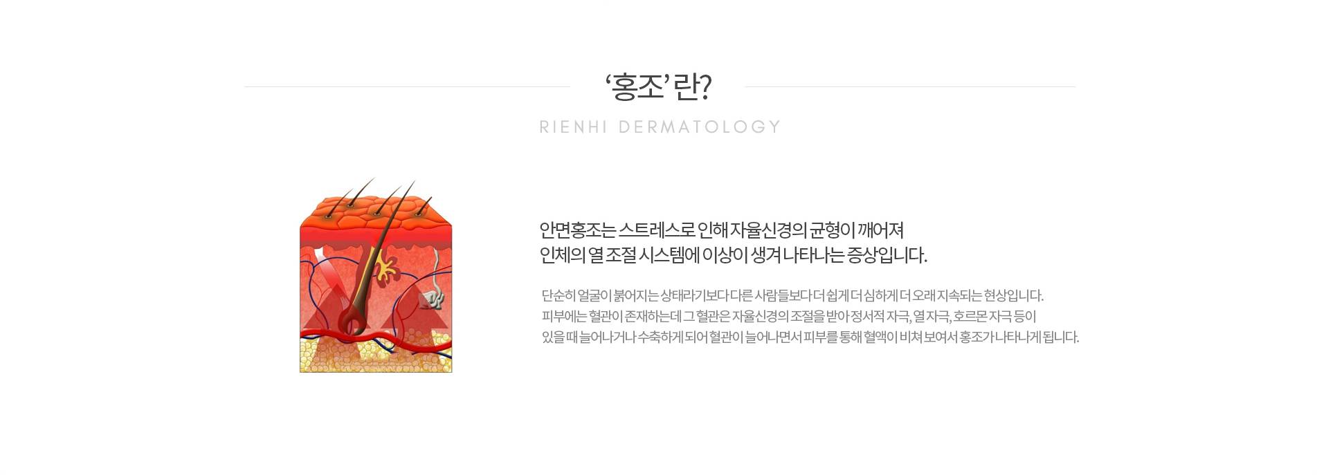 안면홍조&혈관종이란?