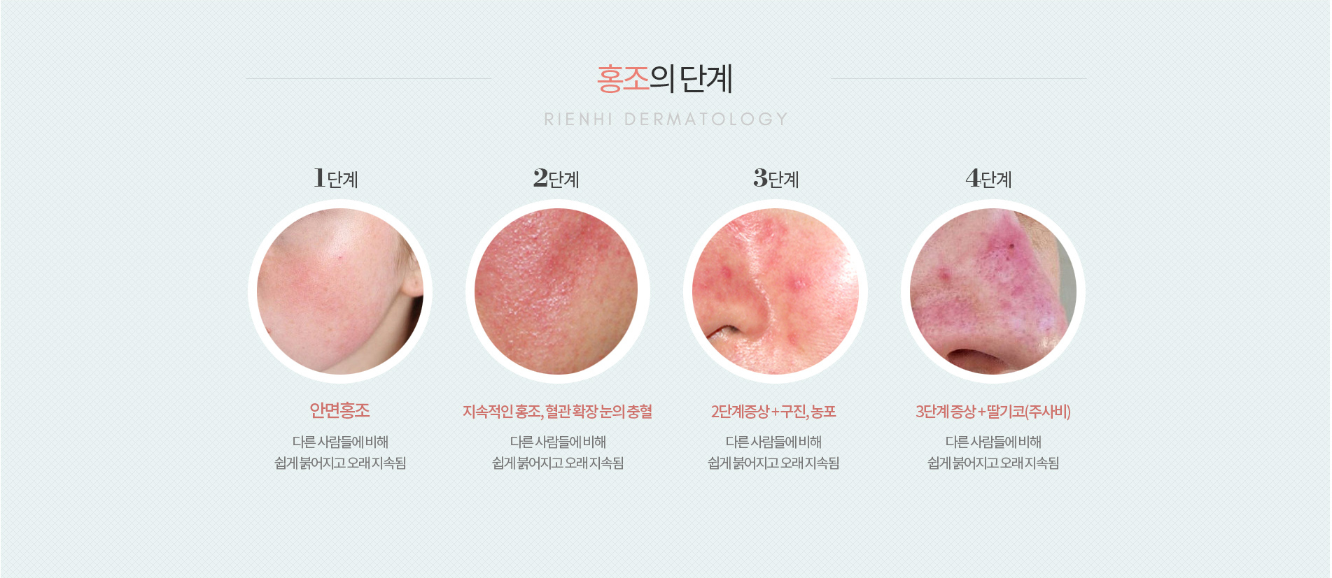 홍조의단계