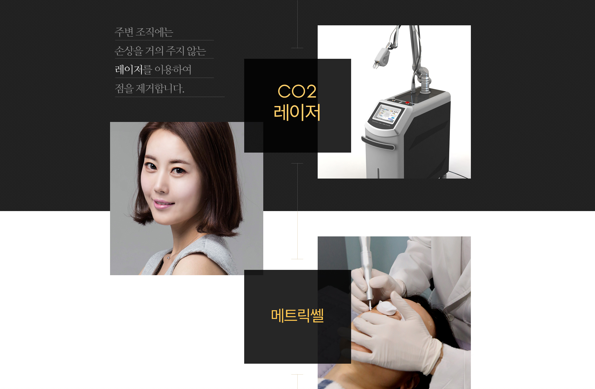 co2레이저,메트릭셀