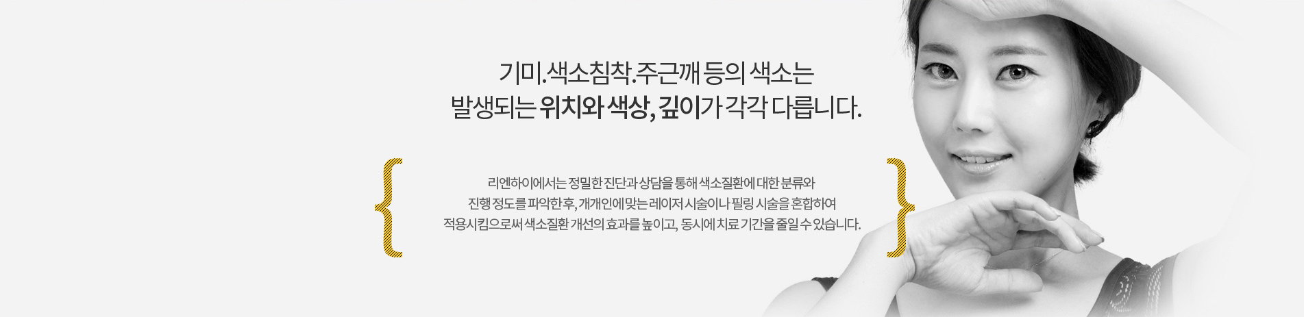 기미,색소침착,주근깨등의 색소는 위치,색상,깊이가 다릅니다.