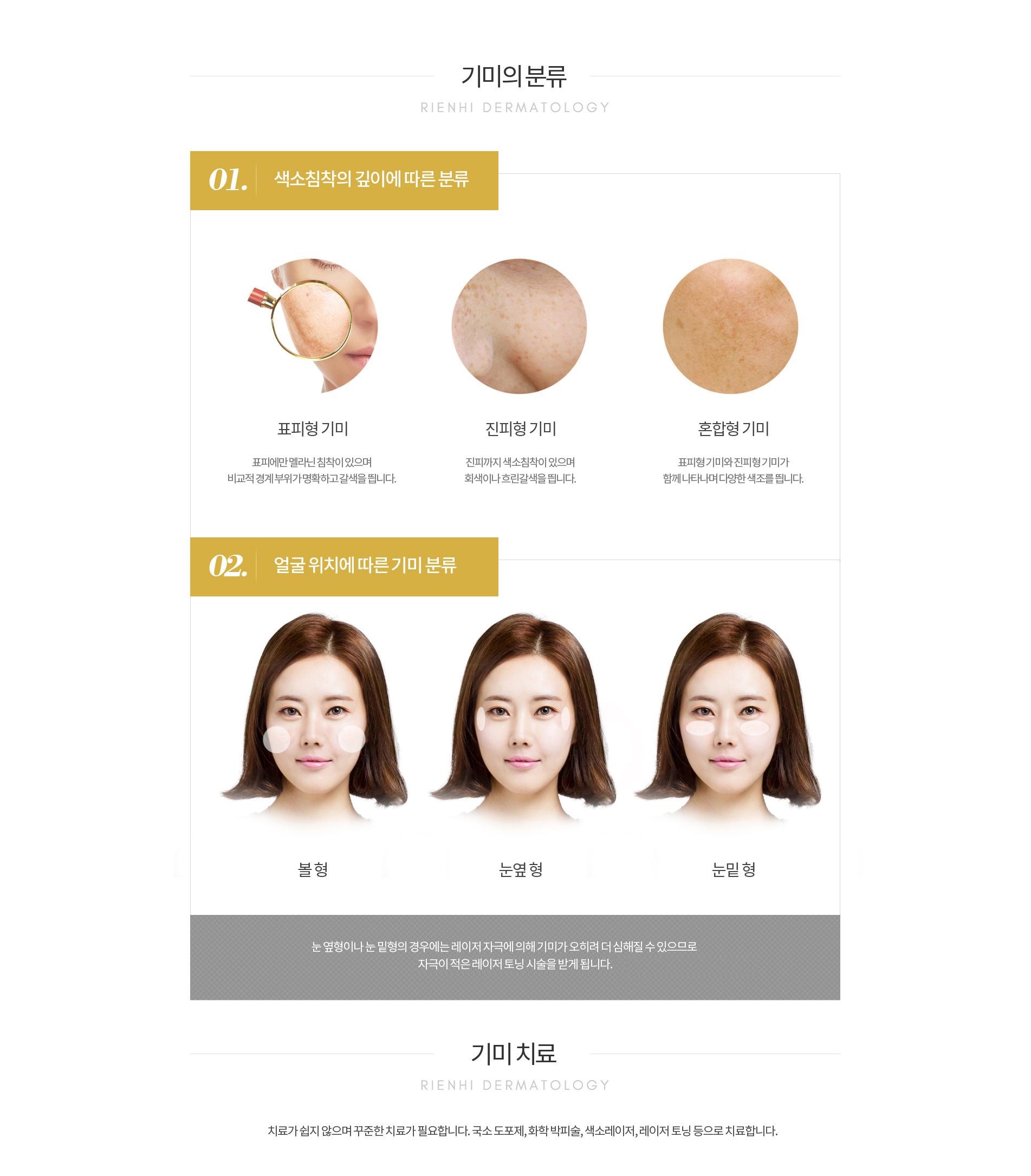 기미의 분류