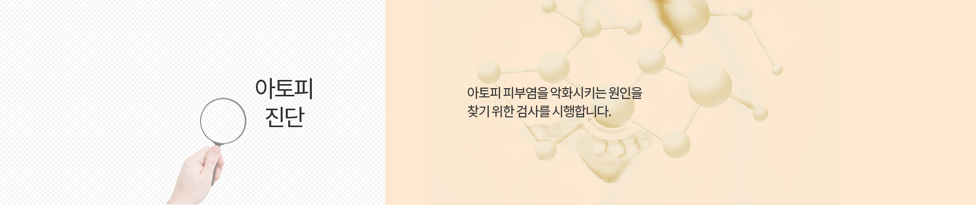 아토피 진단