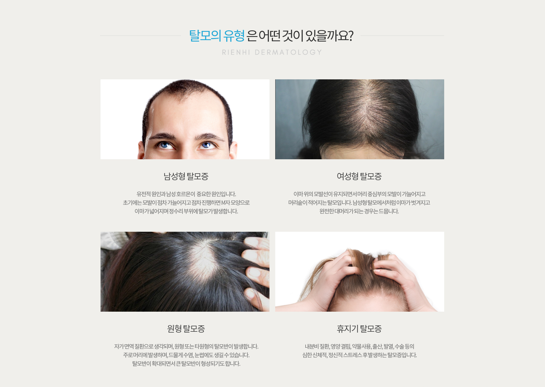 탈모유형