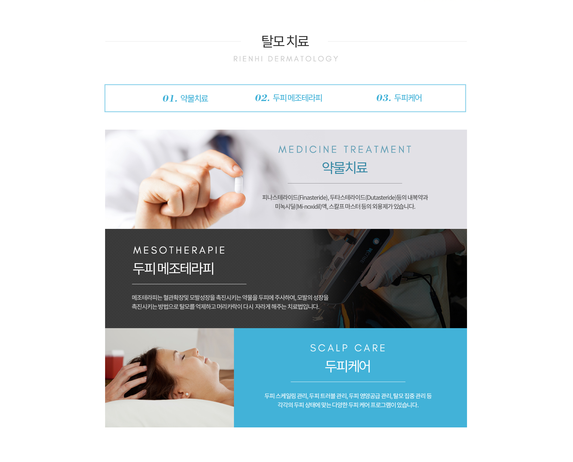 탈모치료
