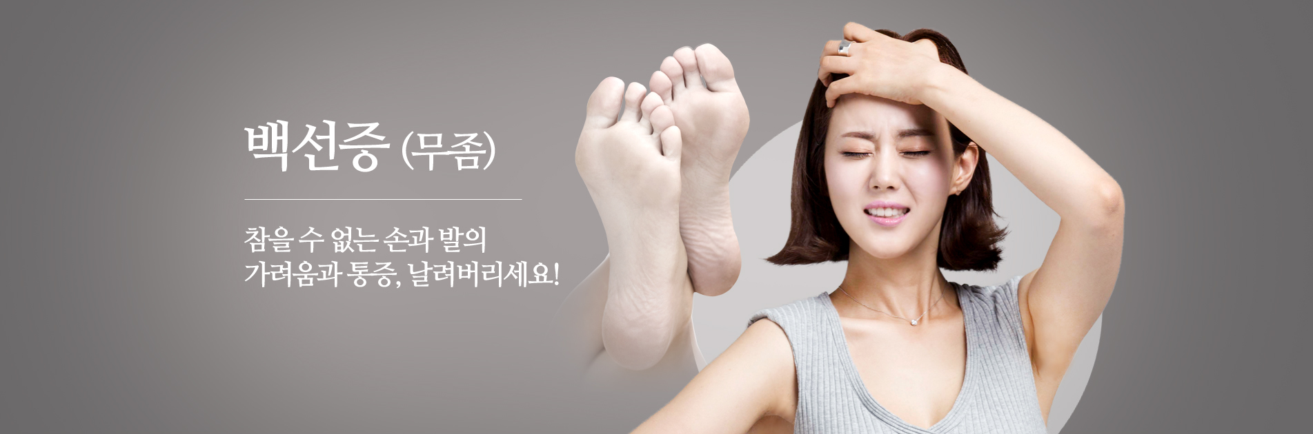 백선증 (무좀)