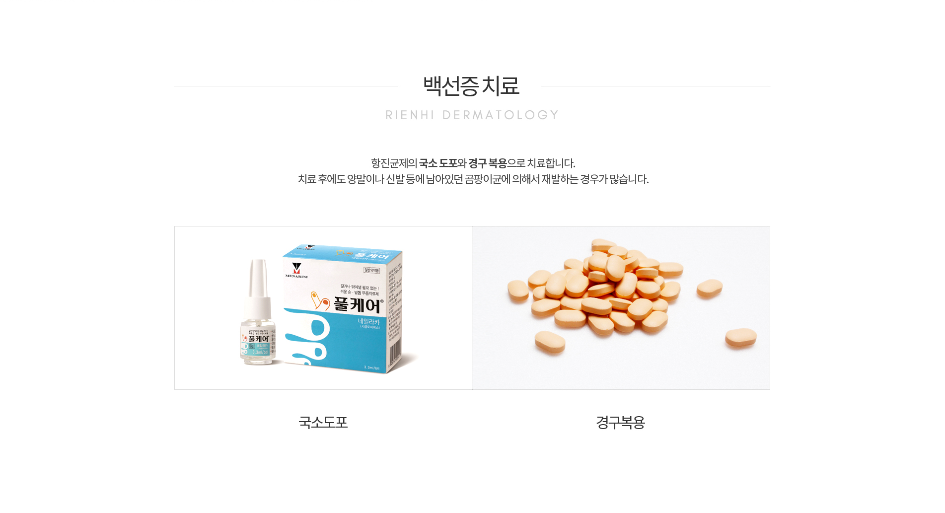 백선증의 치료