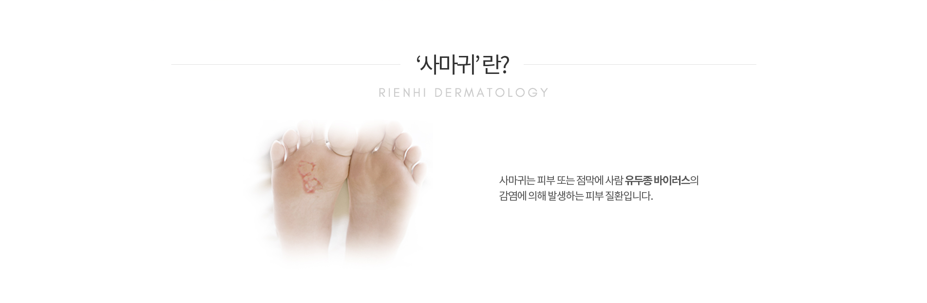 사마귀란
